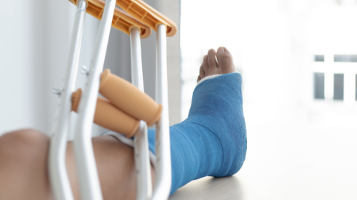 recovering from ACL tear