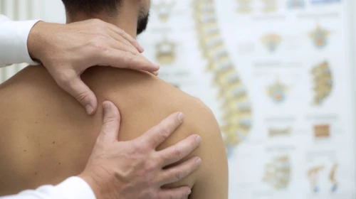 frozen shoulder symptoms | Doctor examining shoulder