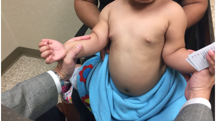 Brachial Plexus and Limb Paralysis Clinic Overview