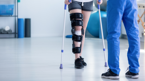 Common Orthopedic Issues and How to Prevent Them