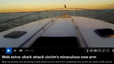 Video: Shark Attack Victim Gets New Arm