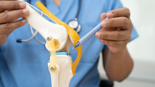 Early Recovery After Total Joint Replacement: What to Expect