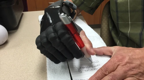helping hand - artificial limbs