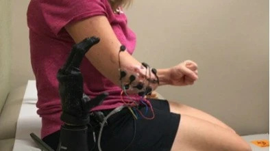 New Amputee Surgical Technique