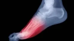 Common Foot Conditions Treated with Orthotics