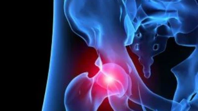 Joint - X-ray