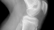 X-ray