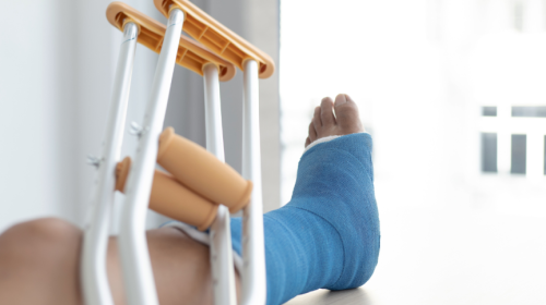 What to Expect When Your Child Needs Orthopedic Surgery