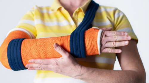 Patient with arm fracture