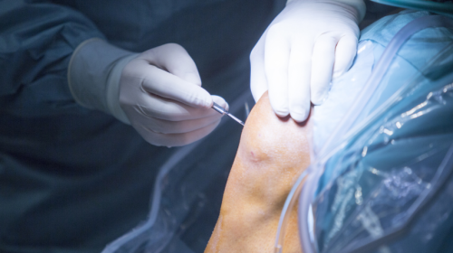 Photo of orthopedic specialist performing same day treatment on patient