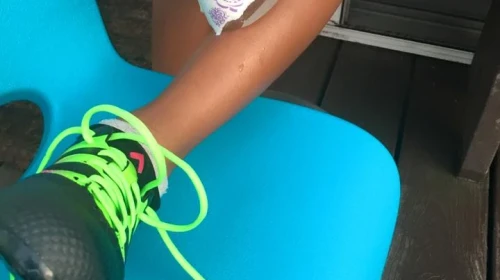 Shin Splints - Icing