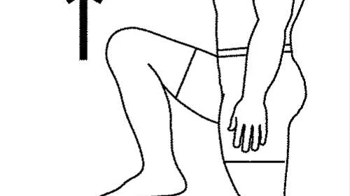 Osteoporosis and Exercise