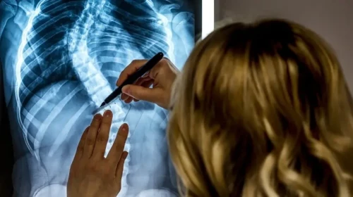 physician pointing at back x-ray