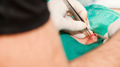 Why Non-Hospital Surgery is a Smart Choice for Your Child’s Recovery
