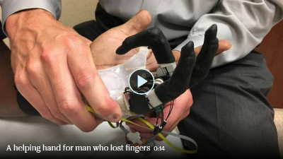 Artificial hand Video