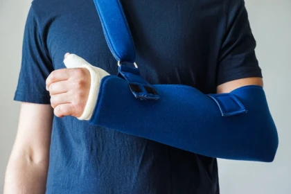 Cast/Splint Care Instructions