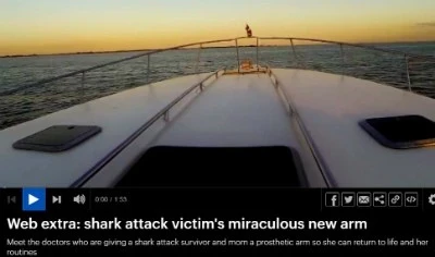 Video: Shark Attack Victim Gets New Arm