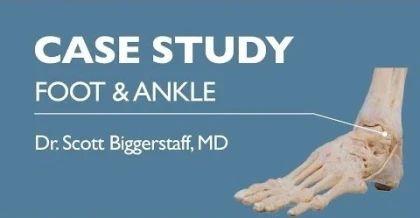 Case Study Foot & Ankle