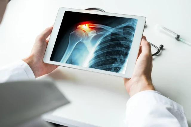 Scan of a shoulder injury on a tablet