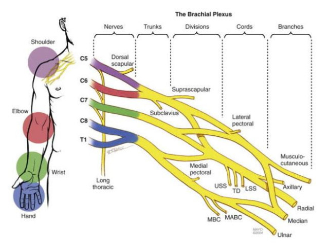 FOR PHYSCIANS: Restoring elbow flexion after Brachial Plexus Injuries