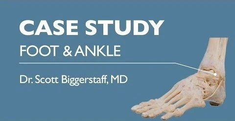 Case Study Foot & Ankle