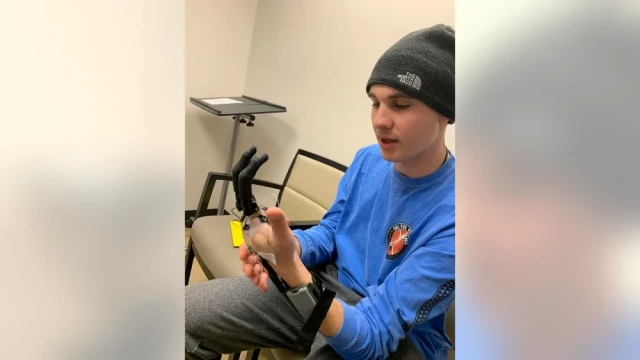 Army veteran regains ability to move fingers with prosthetic