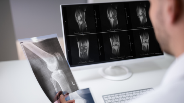 A Smarter Way to Access Orthopedic Care: The State Health Plan & Lantern
