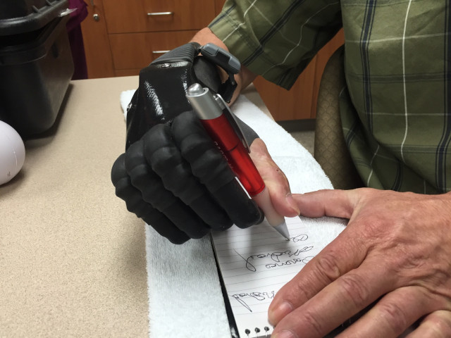 helping hand - artificial limbs