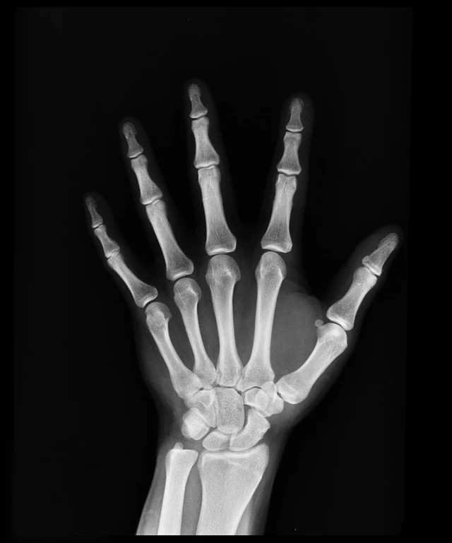 X-ray