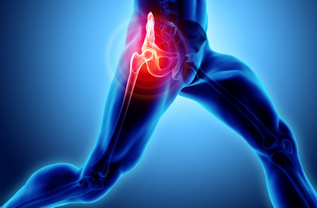 OrthoCarolina Hip and Knee Surgeons Establish Periprosthetic Joint Infection Center