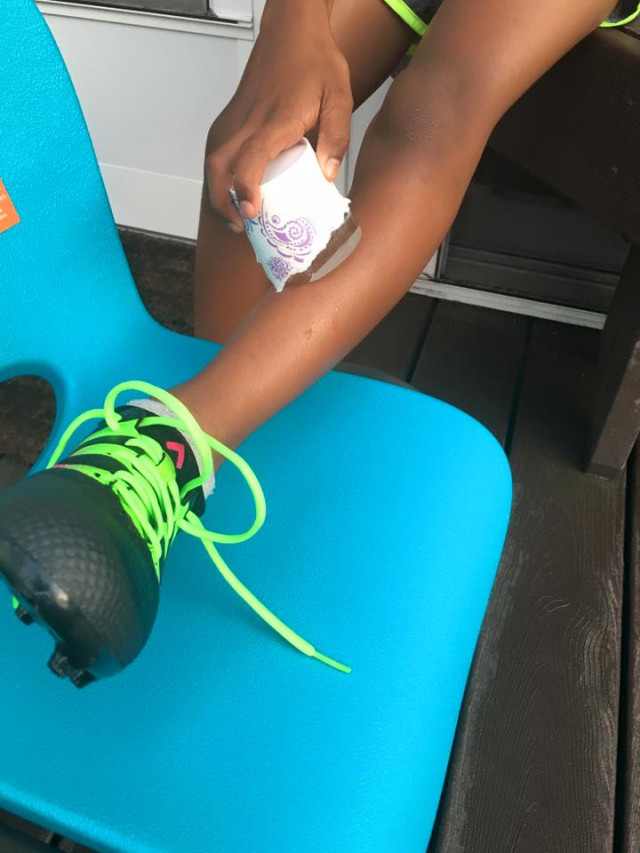 Shin Splints - Icing