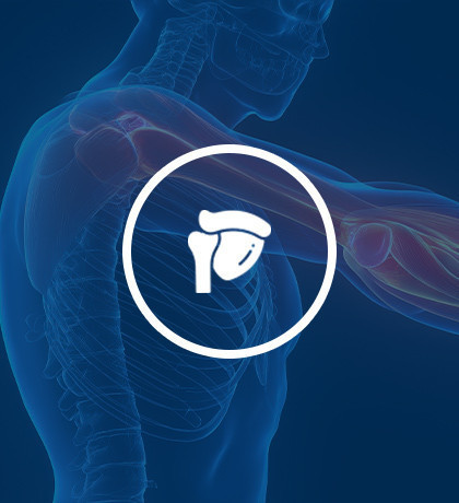Shoulder Advanced Reconstruction and Replacement Specialty Clinic