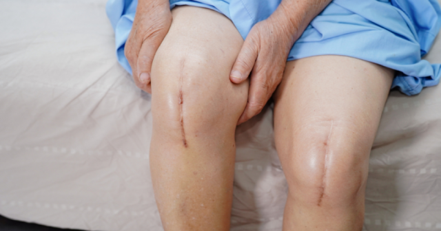 Patient recovering from knee replacement surgery