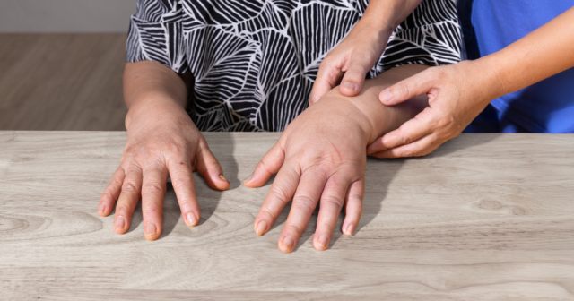Orthopedic doctor assessing a patients swollen hand