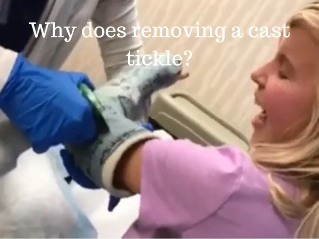 Cast Removal OrthoCarolina