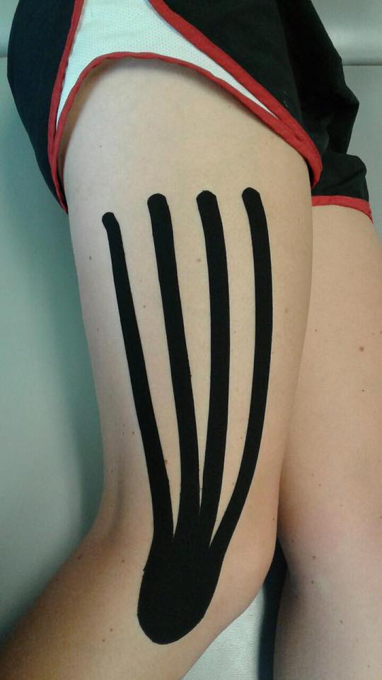 Kinesiology Tape – Tips for Maximum Benefits, Orthopedic Blog