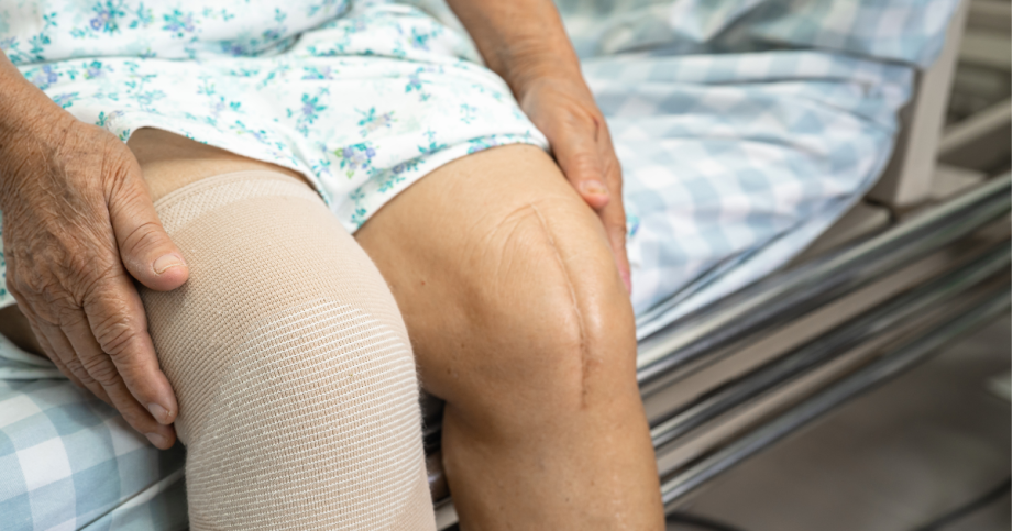 Knee replacement scar.