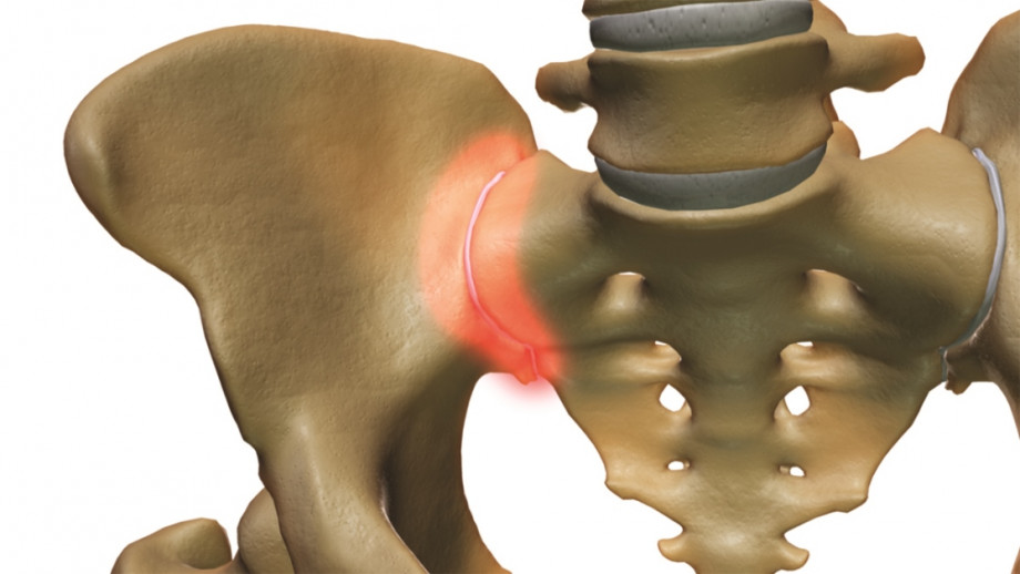 Joint Problem Areas Joint Problem Areas