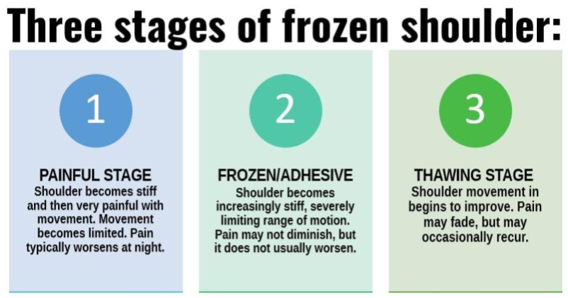 Three Stages of Frozen Shoulder from OrthoCarolina Three Stages of Frozen Shoulder from OrthoCarolina