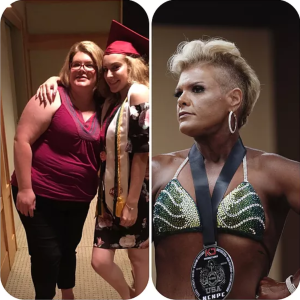 OrthoCarolina's Melissa Bisnet, before & after