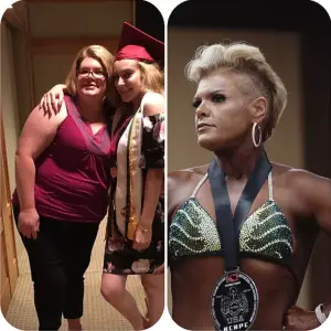 OrthoCarolina's Melissa Bisnet, before & after OrthoCarolina's Melissa Bisnet, before & after