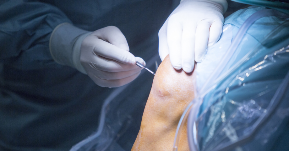 Photo of orthopedic specialist performing same day treatment on patient