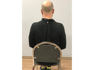 Scapular retractions Scapular retractions