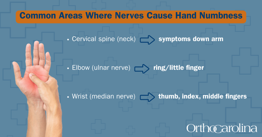 Graphic explaining the common areas where nerves cause hand numbness